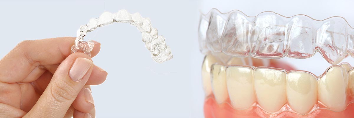 Cumming Alternative to Braces for Teens