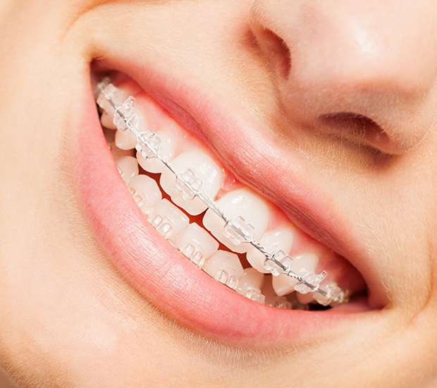 Cumming Invisible Orthodontics