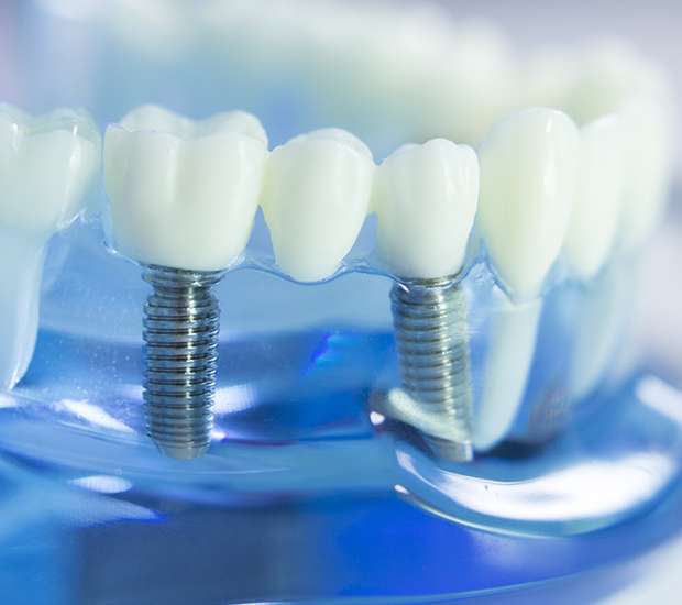 Cumming Dental Prosthetics