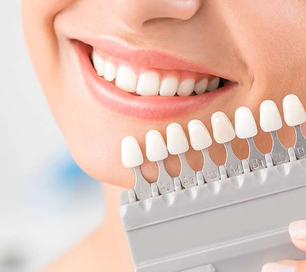 Cumming Veneers