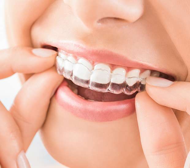 Cumming Does Invisalign® Really Work?