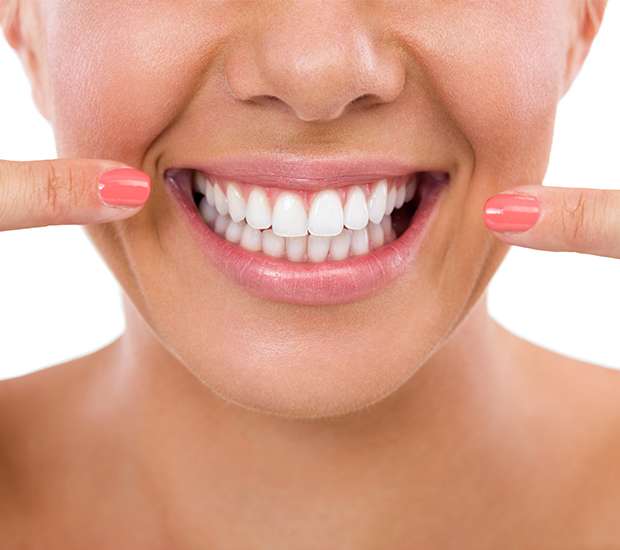 Cumming What Is Gum Contouring and Reshaping