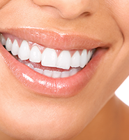 Teeth Whitening Services Cumming, GA